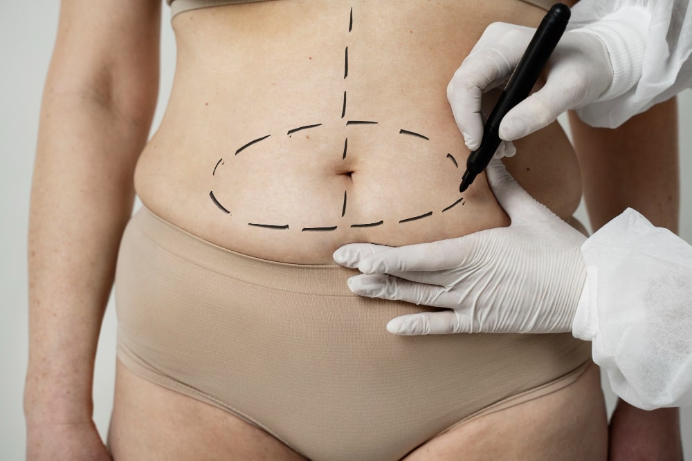 abdominoplastia en Granada con resultados naturales