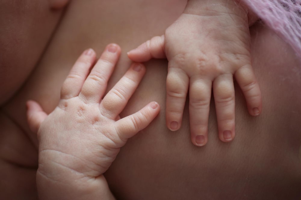 cirugía de lesiones cutáneas pediátricas