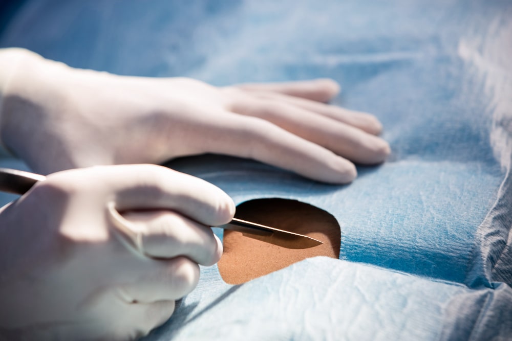 cirugia menor en dr diaz molina