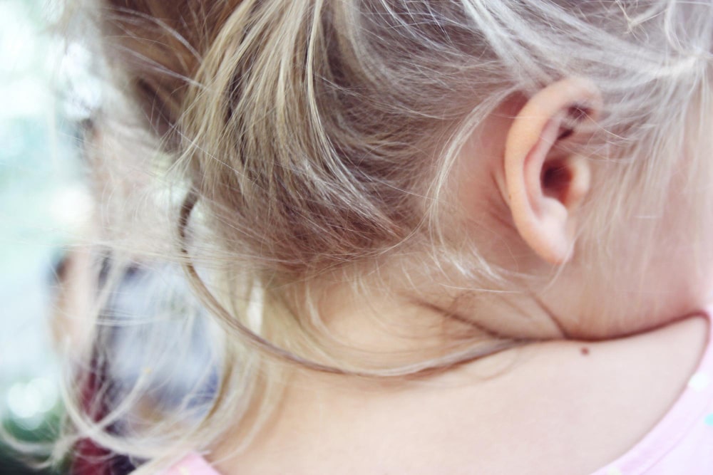 corrección de anomalías auriculares pediátricas