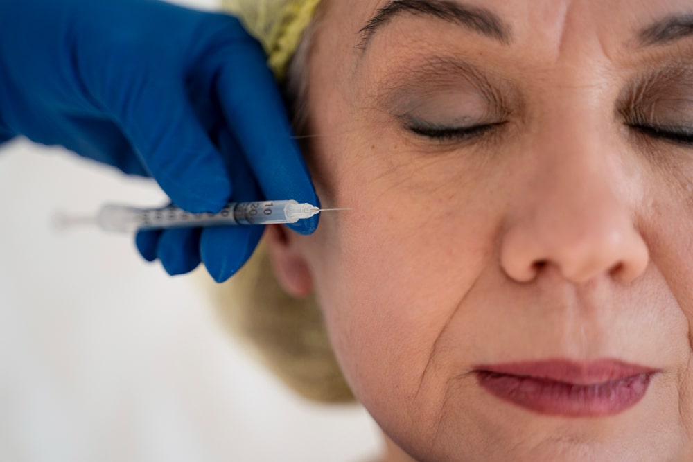 lipofilling facial en Granada